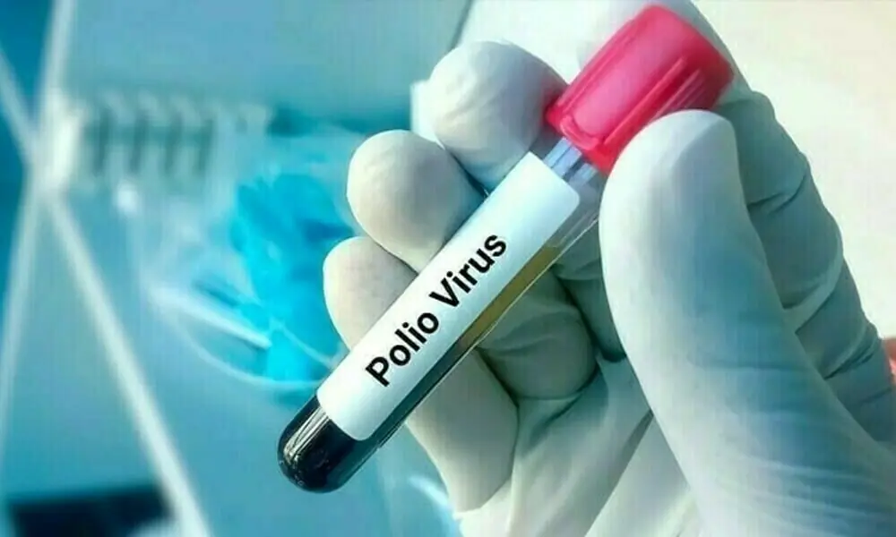 Virus